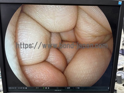 Video Gastroscope&nbsp;|&nbsp;FUJIFILM&nbsp;|&nbsp;EG-530NW