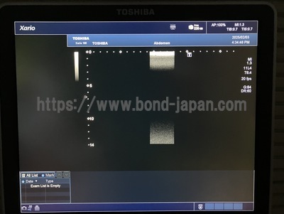 Color Doppler&nbsp;|&nbsp;CANON&nbsp;|&nbsp;TUS-X100 Xario 100