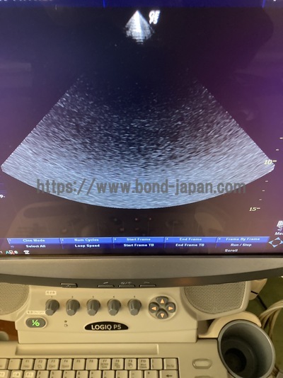 Color Doppler&nbsp;|&nbsp;GE&nbsp;|&nbsp;LOGIQ P5