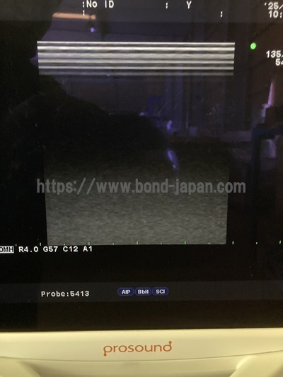 Color Doppler&nbsp;|&nbsp;HITACHI&nbsp;|&nbsp;Prosound α6