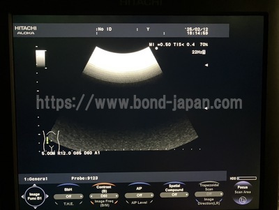 Color Doppler&nbsp;|&nbsp;HITACHI&nbsp;|&nbsp;F37