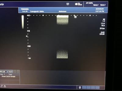 Color Doppler&nbsp;|&nbsp;CANON&nbsp;|&nbsp;Xario 200