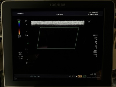 Color Doppler&nbsp;|&nbsp;CANON&nbsp;|&nbsp;SSA-660A Xario