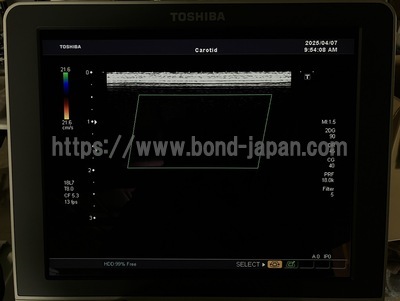 Color Doppler&nbsp;|&nbsp;CANON&nbsp;|&nbsp;SSA-660A Xario