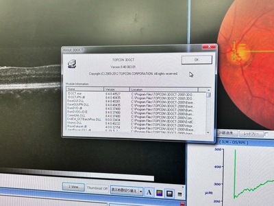 OCT&nbsp;|&nbsp;TOPCON&nbsp;|&nbsp;3D OCT 1 / Maestro 1
