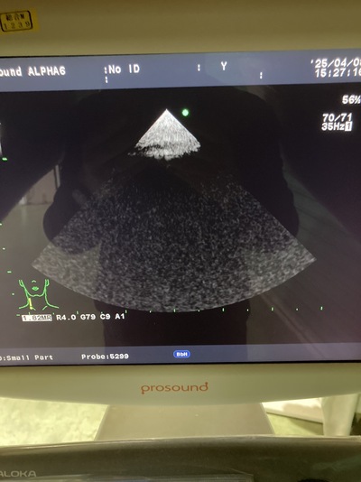 Color Doppler&nbsp;|&nbsp;HITACHI&nbsp;|&nbsp;Prosound α6