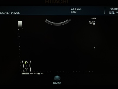 Ultrasound System&nbsp;|&nbsp;FUJIFILM&nbsp;|&nbsp;ARIETTA 50