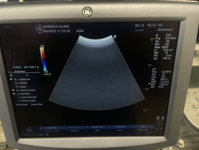 Color Doppler&nbsp;|&nbsp;GE&nbsp;|&nbsp;LOGIQ P5