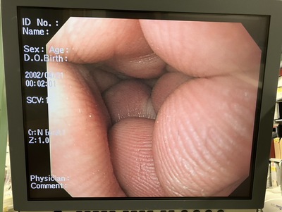 Video Gastroscope&nbsp;|&nbsp;OLYMPUS&nbsp;|&nbsp;GIF-H260