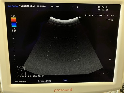 Ultrasound System&nbsp;|&nbsp;HITACHI&nbsp;|&nbsp;Prosound α7