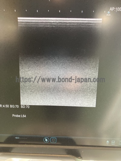 &nbsp;|&nbsp;Fujifilm&nbsp;|&nbsp;ARIETTA 70