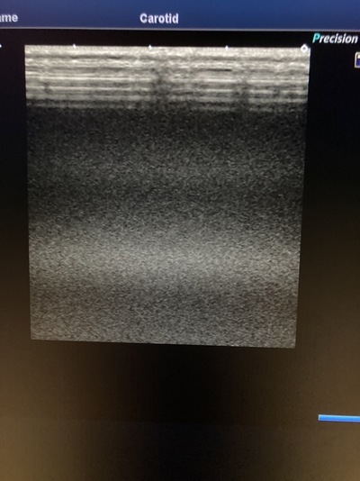 Color Doppler&nbsp;|&nbsp;CANON&nbsp;|&nbsp;Xario 200