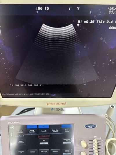 Color Doppler&nbsp;|&nbsp;HITACHI&nbsp;|&nbsp;Prosound α6