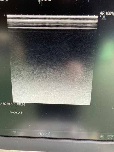 Ultrasound System&nbsp;|&nbsp;HITACHI&nbsp;|&nbsp;ARIETTA 60