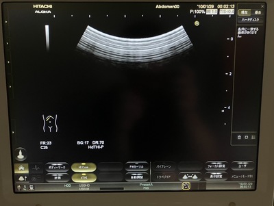 Ultrasound&nbsp;|&nbsp;HITACHI&nbsp;|&nbsp;Noblus