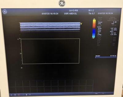 Ultrasound&nbsp;|&nbsp;GE&nbsp;|&nbsp;Vivid T8