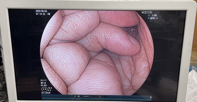 Video Gastroscope&nbsp;|&nbsp;FUJIFILM&nbsp;|&nbsp;EG-L590ZW