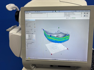 OCT&nbsp;|&nbsp;Carl Zeiss&nbsp;|&nbsp;Cirrus 500 HD-OCT Plus