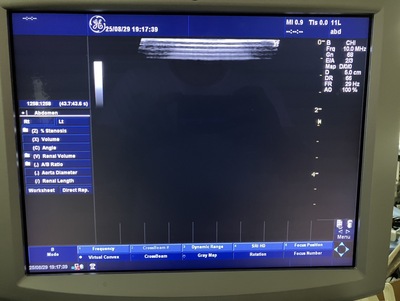 Color Doppler&nbsp;|&nbsp;GE&nbsp;|&nbsp;LOGIQ P5