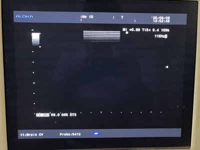Ultrasound System&nbsp;|&nbsp;HITACHI&nbsp;|&nbsp;Prosound α7