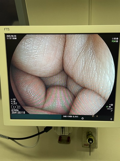 Video Gastroscope&nbsp;|&nbsp;FUJIFILM&nbsp;|&nbsp;EG-6400N