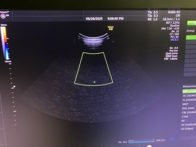 4D Ultrasound&nbsp;|&nbsp;GE&nbsp;|&nbsp;Voluson S10 BT16