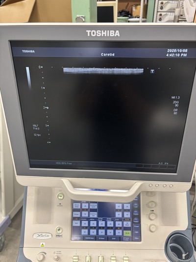 Color Doppler&nbsp;|&nbsp;CANON&nbsp;|&nbsp;SSA-660A Xario