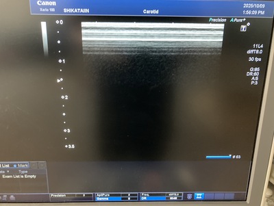 Color Doppler&nbsp;|&nbsp;CANON&nbsp;|&nbsp;TUS-X100 Xario 100