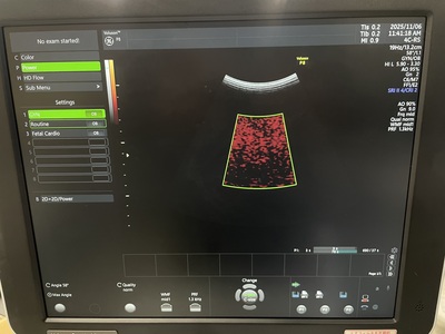 Ultrasound&nbsp;|&nbsp;GE&nbsp;|&nbsp;Voluson P8 BT18