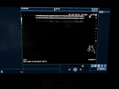 Ultrasound System&nbsp;|&nbsp;FUJIFILM&nbsp;|&nbsp;ARIETTA 850