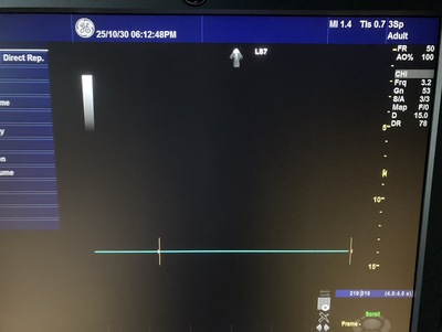 Color Doppler&nbsp;|&nbsp;GE&nbsp;|&nbsp;Logiq S7 Expert