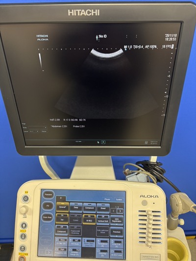 Ultrasound System&nbsp;|&nbsp;HITACHI&nbsp;|&nbsp;ARIETTA 60