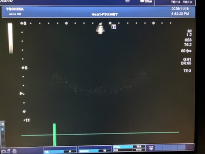 &nbsp;|&nbsp;CANON&nbsp;|&nbsp;TUS-X100S  Xario 100S