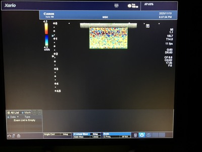 &nbsp;|&nbsp;CANON&nbsp;|&nbsp;TUS-X100S  Xario 100S