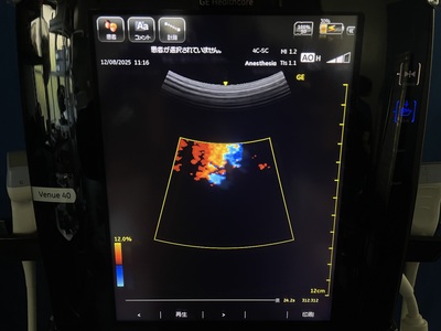 Color Doppler&nbsp;|&nbsp;GE&nbsp;|&nbsp;Venue 40