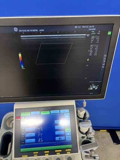 Ultrasound&nbsp;|&nbsp;GE&nbsp;|&nbsp;LOGIQ P9