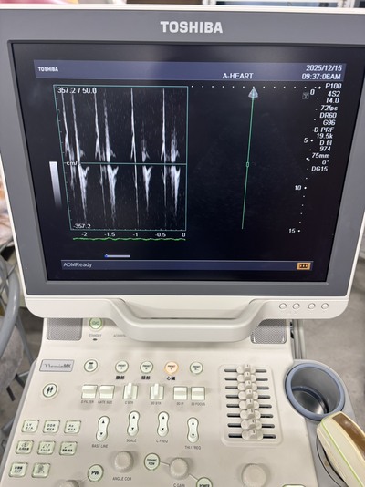 Color Doppler&nbsp;|&nbsp;CANON&nbsp;|&nbsp;SSA-590A Nemio MX