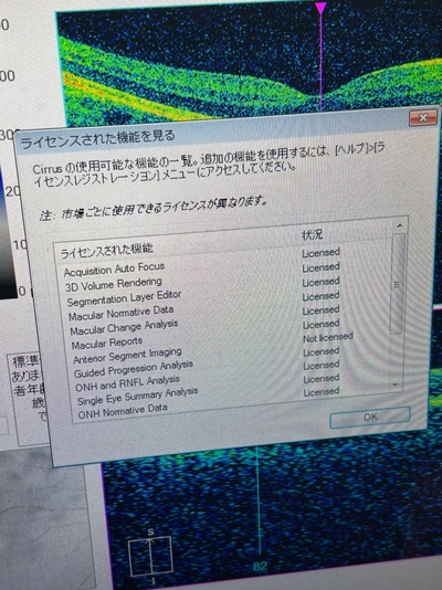 Zeiss OCT&nbsp;|&nbsp;Carl Zeiss&nbsp;|&nbsp;Cirrus 500 HD-OCT Plus