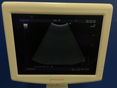 Color Doppler&nbsp;|&nbsp;ALOKA&nbsp;|&nbsp;SSD-3500SX