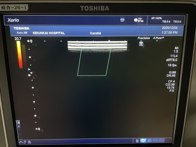 Color Doppler&nbsp;|&nbsp;CANON&nbsp;|&nbsp;Xario 200