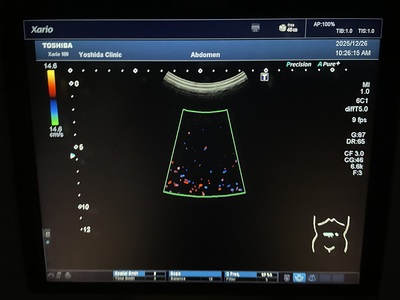 Color Doppler&nbsp;|&nbsp;CANON&nbsp;|&nbsp;TUS-X100 Xario 100