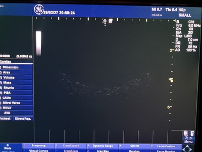 Color Doppler&nbsp;|&nbsp;GE&nbsp;|&nbsp;LOGIQ P5