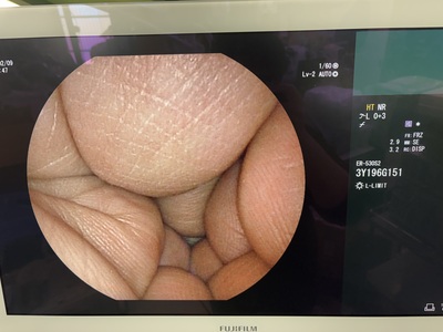 Rhino-Laryngoscope&nbsp;|&nbsp;FUJIFILM&nbsp;|&nbsp;ER-530S2