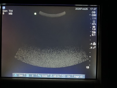 Color Doppler&nbsp;|&nbsp;SonoSite&nbsp;|&nbsp;M-Turbo