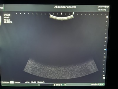 Portable Ultrasound&nbsp;|&nbsp;FUJIFILM&nbsp;|&nbsp;FC1-X