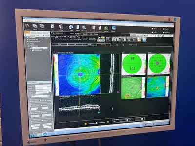 OCT with Fundus function&nbsp;|&nbsp;NIDEK&nbsp;|&nbsp;RS-3000 Advance