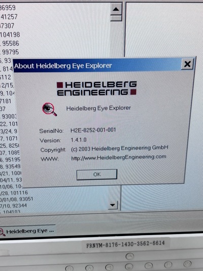 Retina Topo&nbsp;|&nbsp;Heidelberg Engineering GmbH&nbsp;|&nbsp;Retina Tomograph 2 HRT II