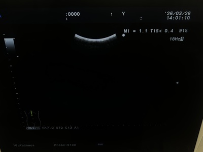 Ultrasound System&nbsp;|&nbsp;HITACHI&nbsp;|&nbsp;Prosound α7