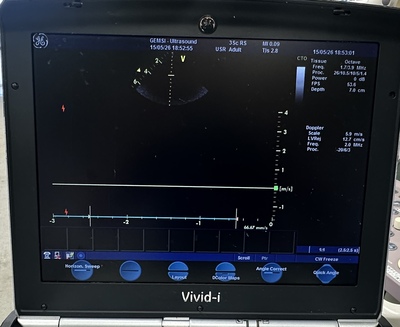 Color Doppler&nbsp;|&nbsp;GE&nbsp;|&nbsp;Vivid i