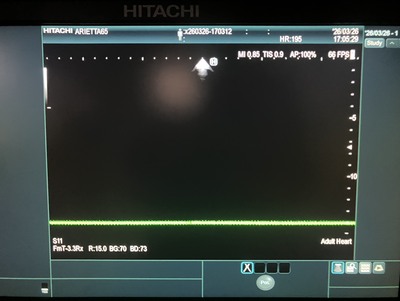 Ultrasound&nbsp;|&nbsp;HITACHI&nbsp;|&nbsp;Arietta 65